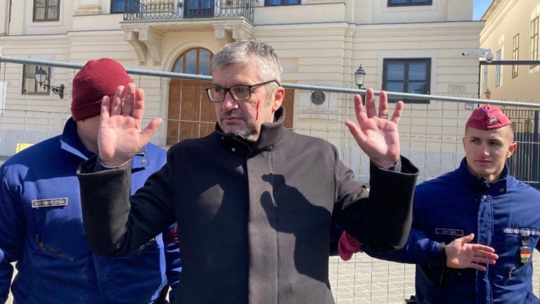 Hadházy Ákos a 2023. április 5-én a Karmelita kolostornál történt incidens során szerzett sérülése.