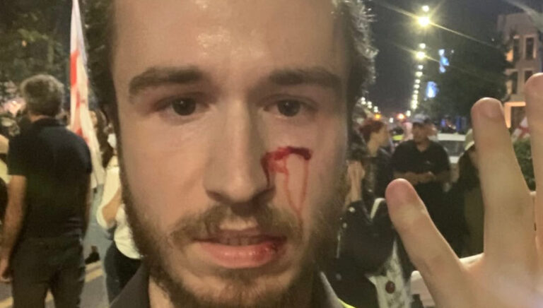 Mézes László Róbert, a Magyar Hang újságírója a Grúz Álom Párt irodája előtt sérült meg